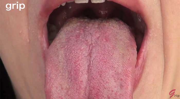 舌