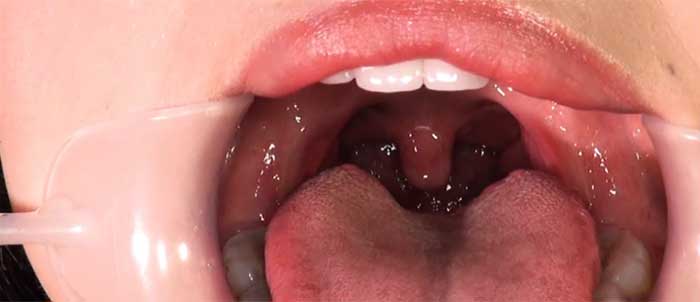口内鑑賞