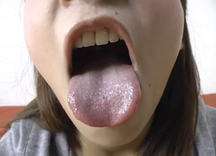 舌見せ