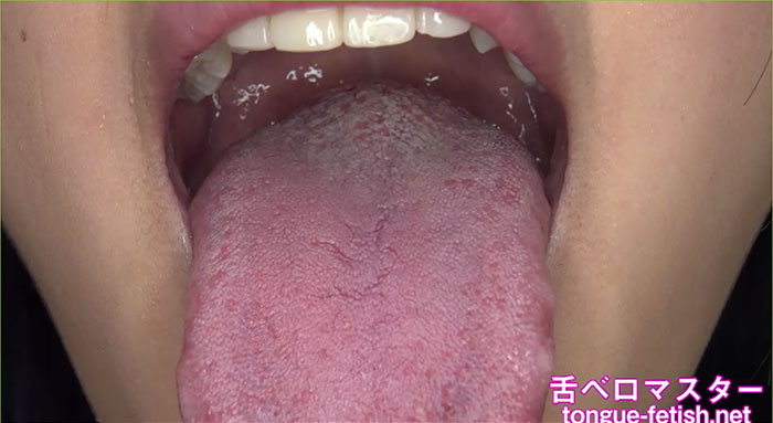 舌苔
