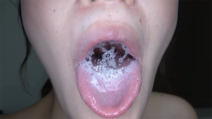 痰唾舌