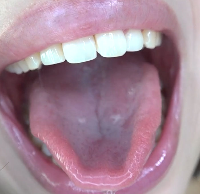 舌見せ