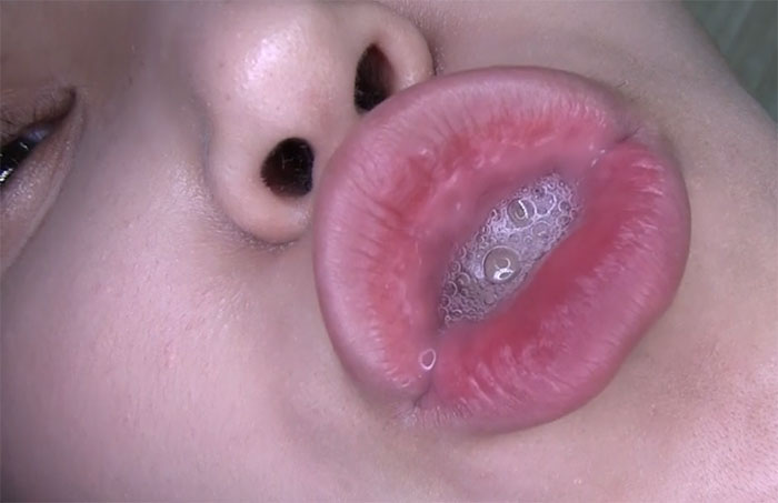 タコチュー唾