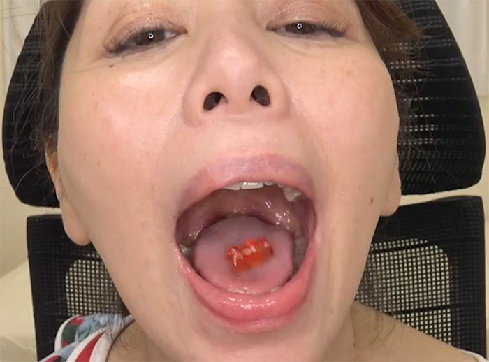 翔田千里口内