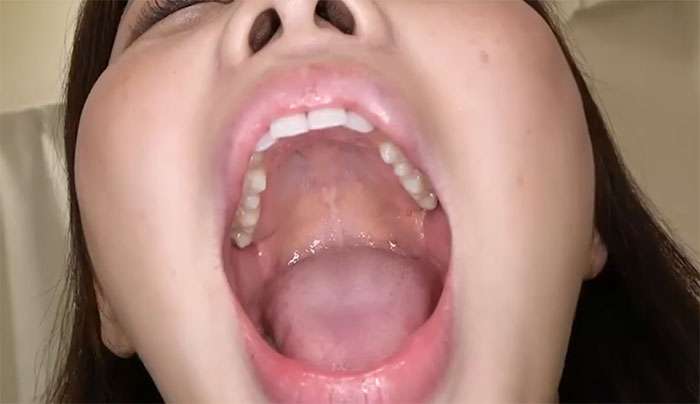 口内観察