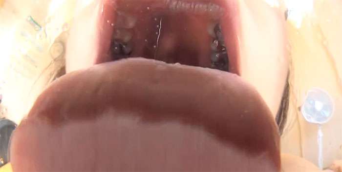 舌